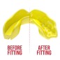 Protège dents SafeJawz® Intro Series - Jaune fluo Protège dents SafeJawz® Intro Series - Jaune fluo