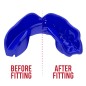 Protège dents SafeJawz® Intro Series - Bleu Protège dents SafeJawz® Intro Series - Bleu