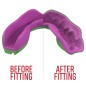Protège dents SafeJawz® Marvel - Hulk Protège dents SafeJawz® Marvel - Hulk