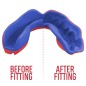 Protège dents SafeJawz® Marvel - Spider-Man Protège dents SafeJawz® Marvel - Spider-Man